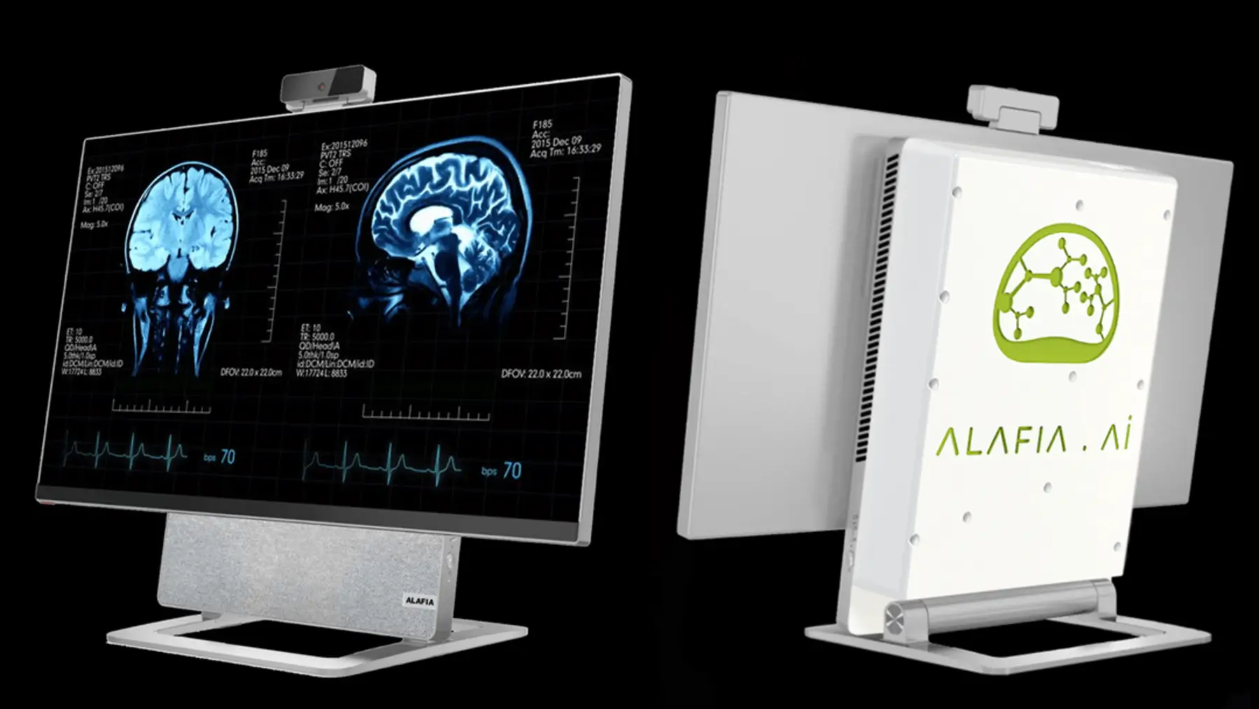 Alafia AI представила Aivas SuperWorkstation для медичної візуалізації